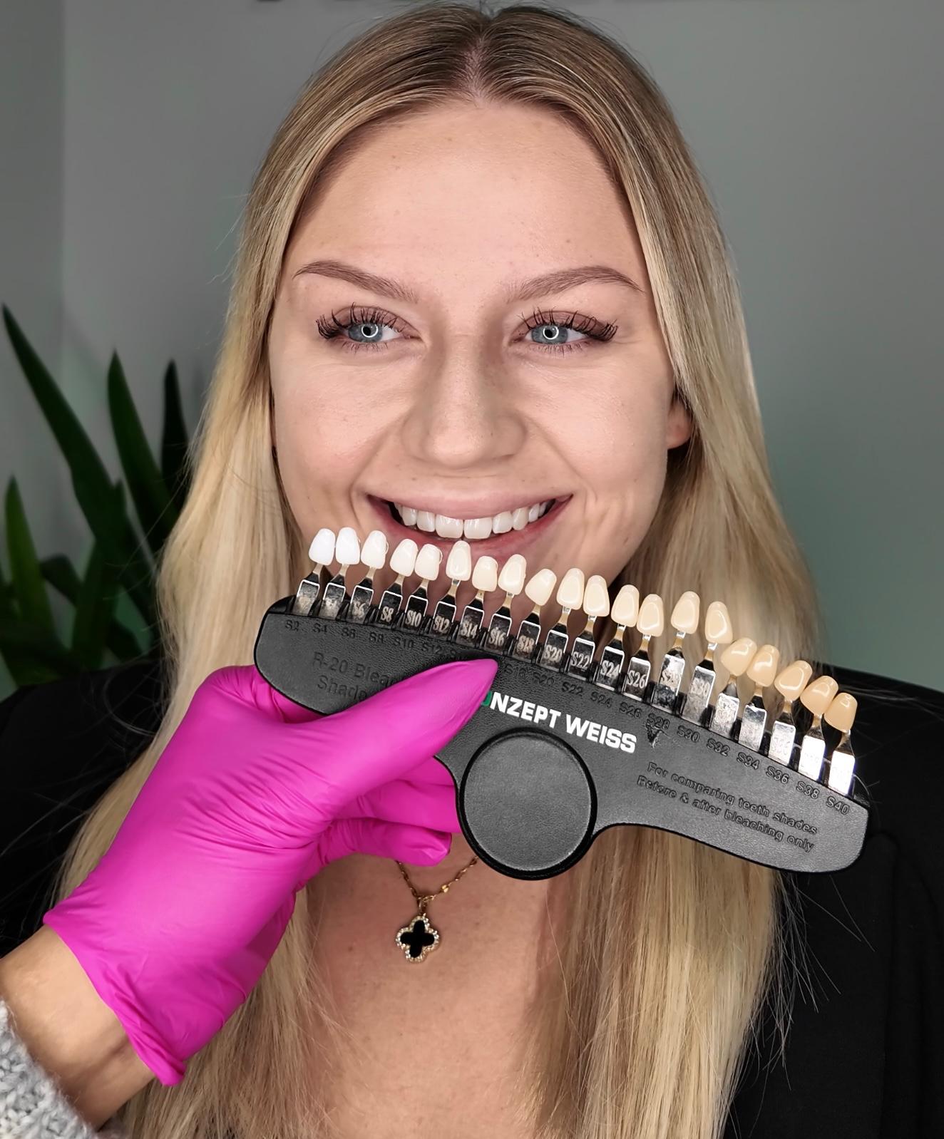 Kundin bei Luxury Beauty by Walaa in Bochum mit Zahnfarbskala zur Bestimmung des Zahnweißtons