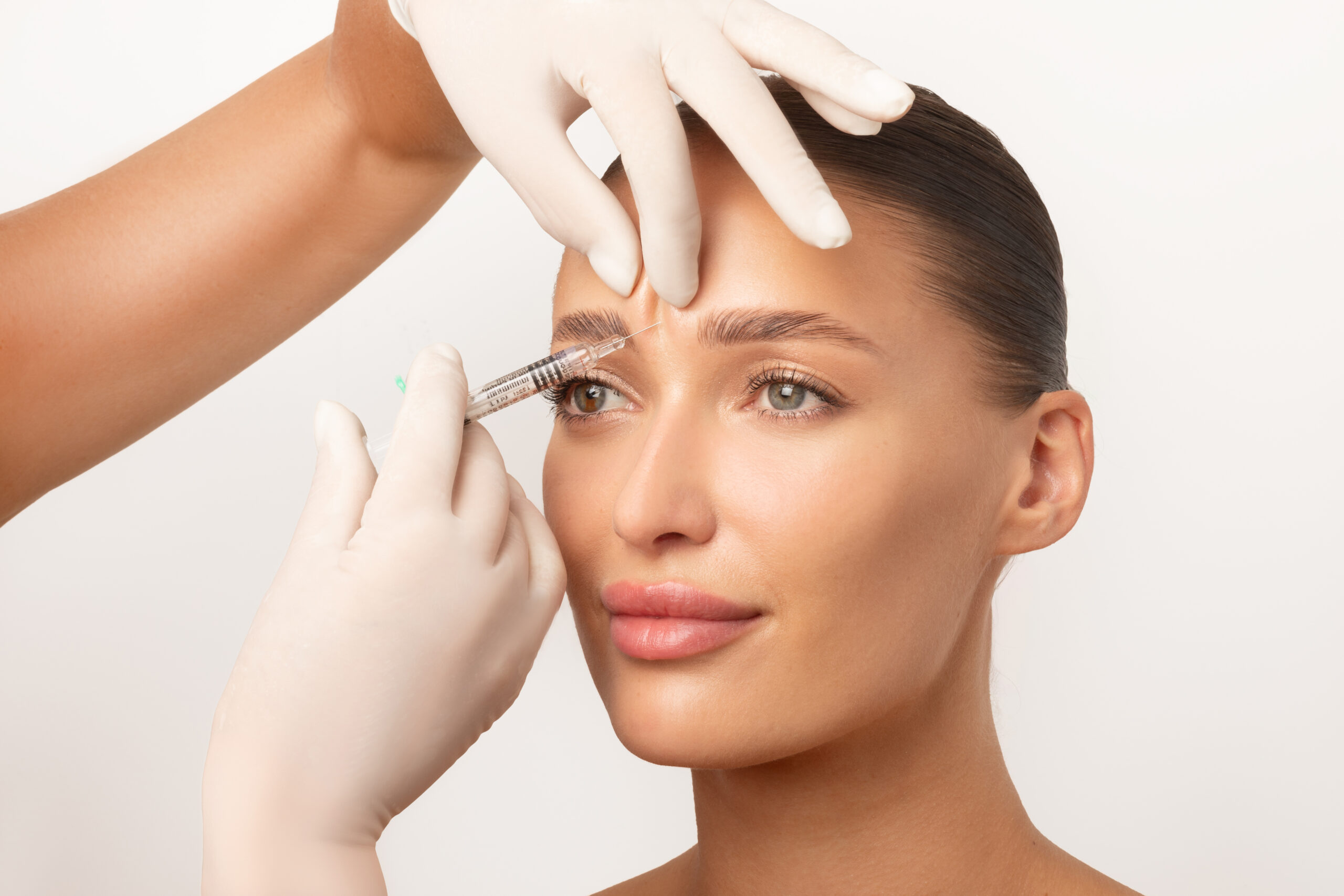 Frau mit glattem Teint erhält eine Botulinum-Injektion zwischen den Augenbrauen, während eine Fachkraft mit weißen Handschuhen ihre Stirn fixiert
