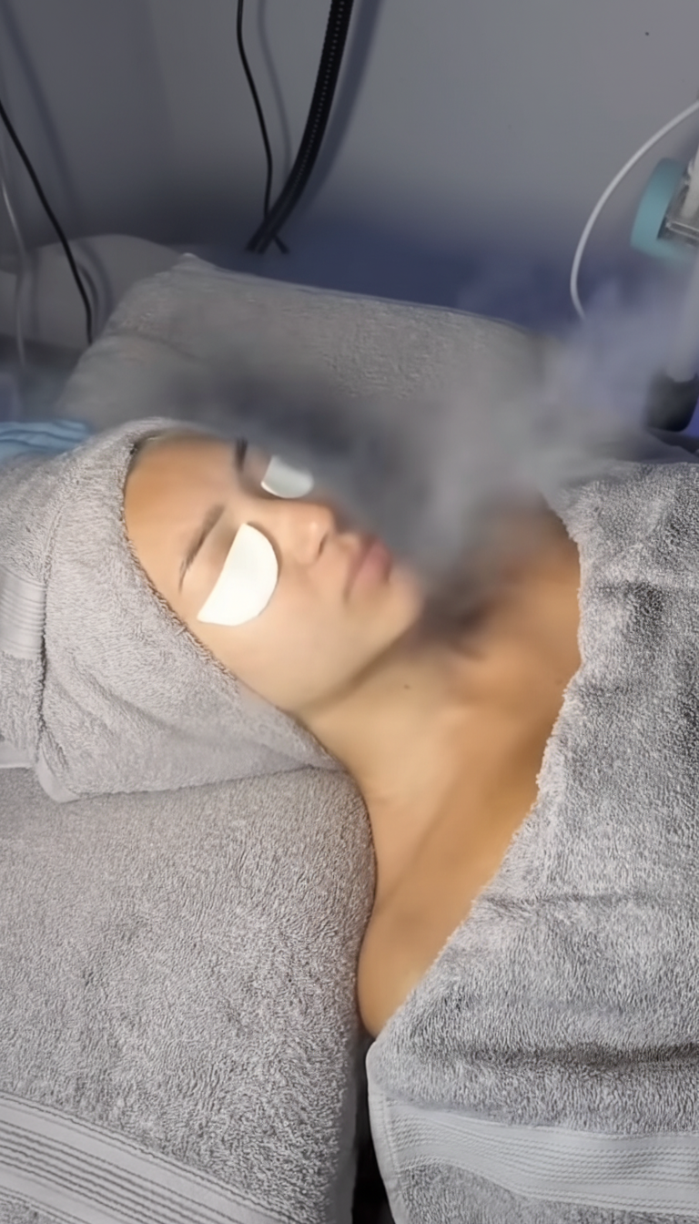 Aquafacial-Behandlung – Bild 4