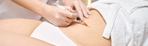 Injektionslipolyse an Zone nach Wahl