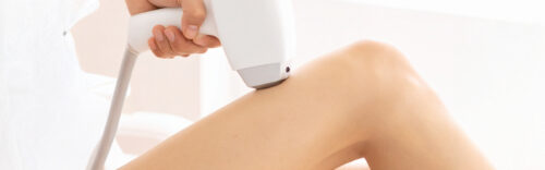 3x Laser-Haarentfernung