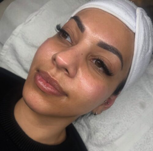 Aquafacial & Microneedling