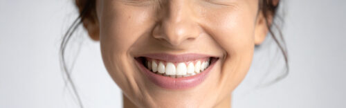 Kosmetische Zahnreinigung & Zahnschmuck