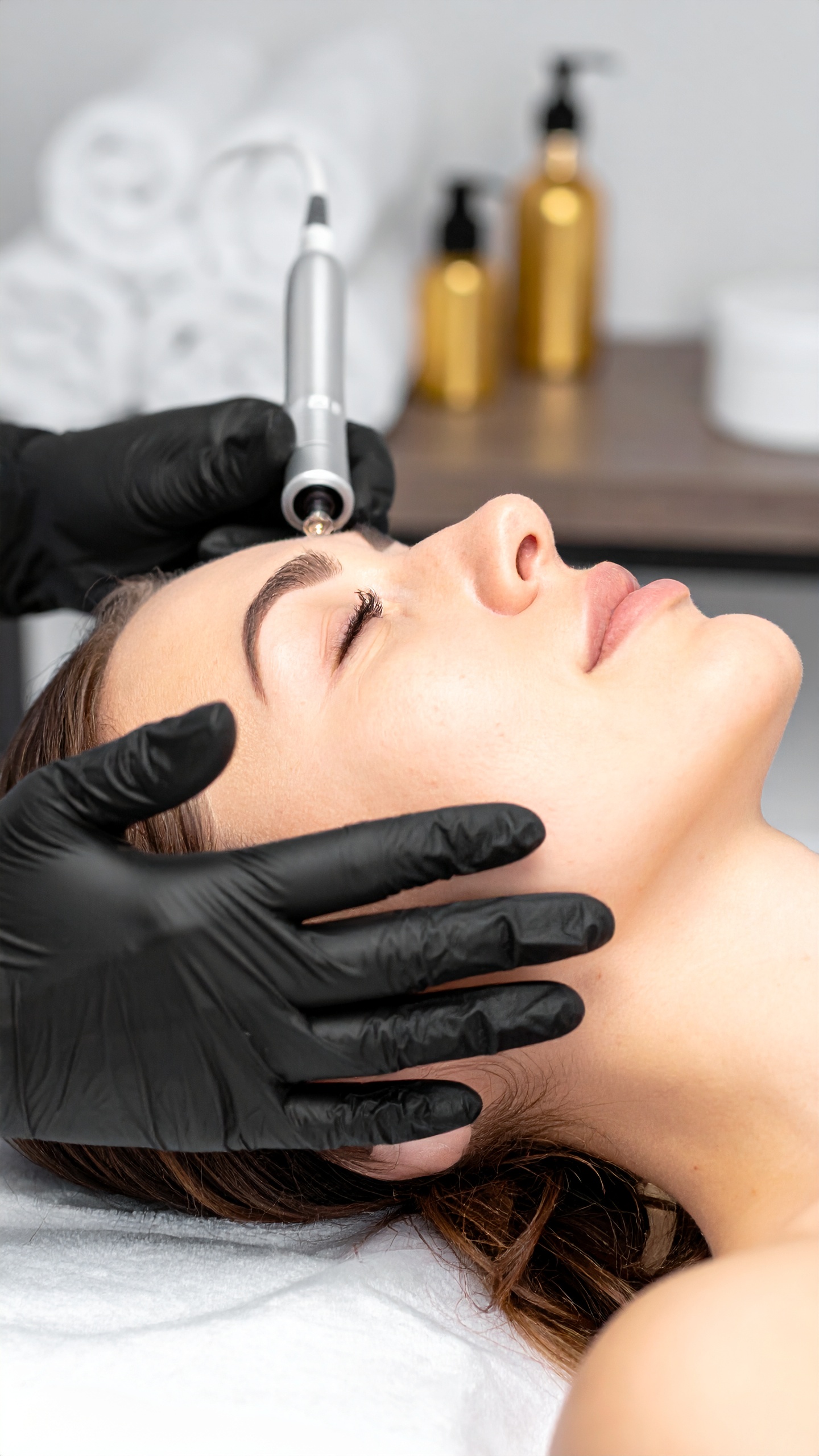 60 Min. Microneedling – Bild 4