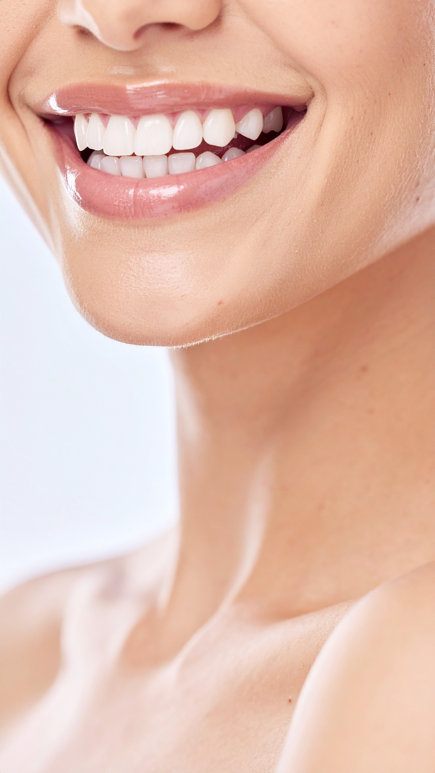 Zahnaufhellung & Zahnschmuck – Bild 4